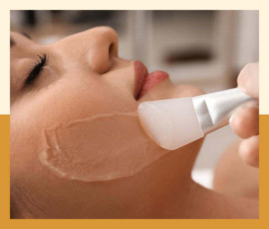 Chemical peels