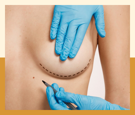 stress urinary incontinence
- Empower RF